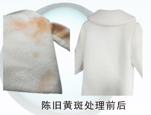 陈旧黄斑处理前后